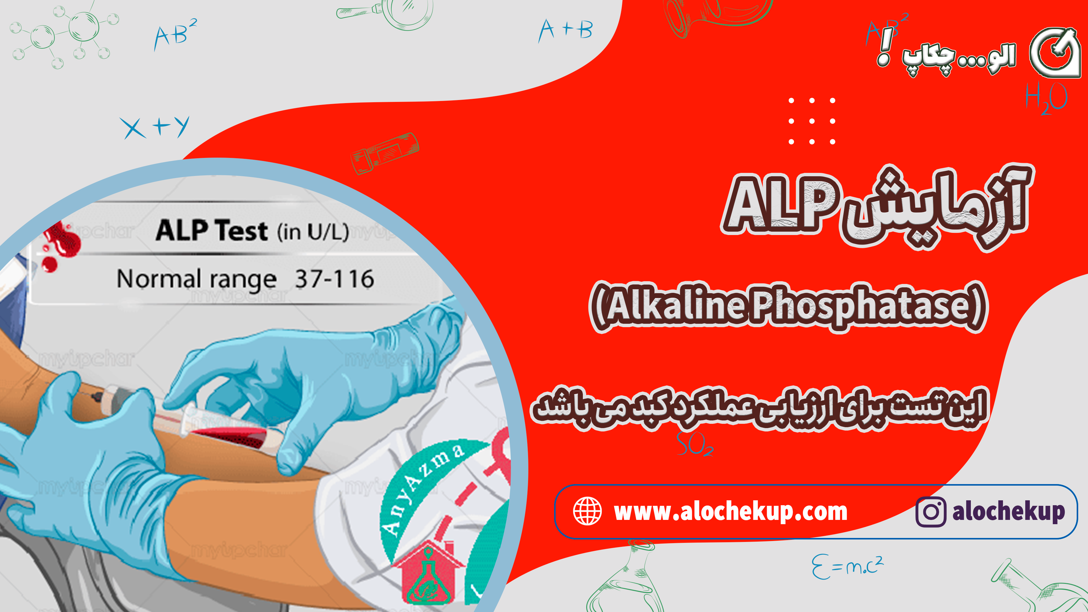 آزمایش ALP (Alkaline Phosphatase)