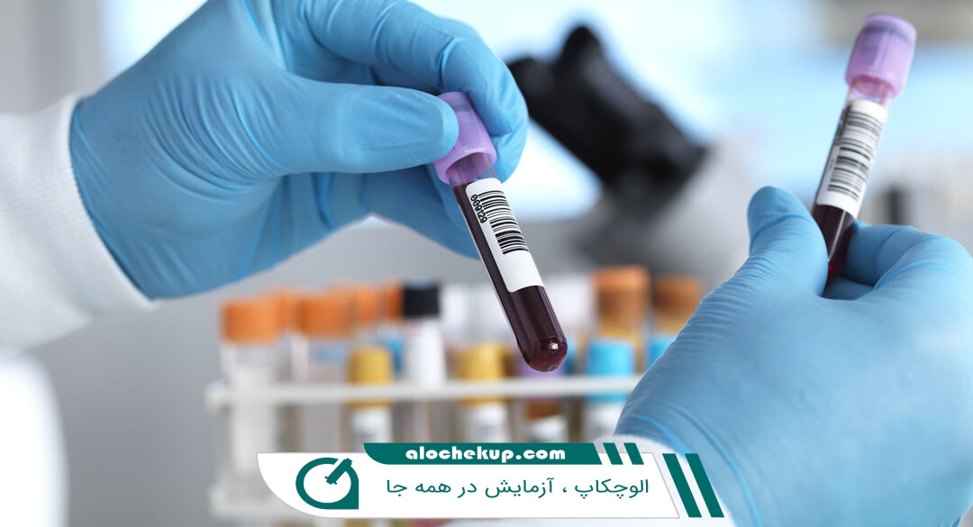 آزمایش خون hct