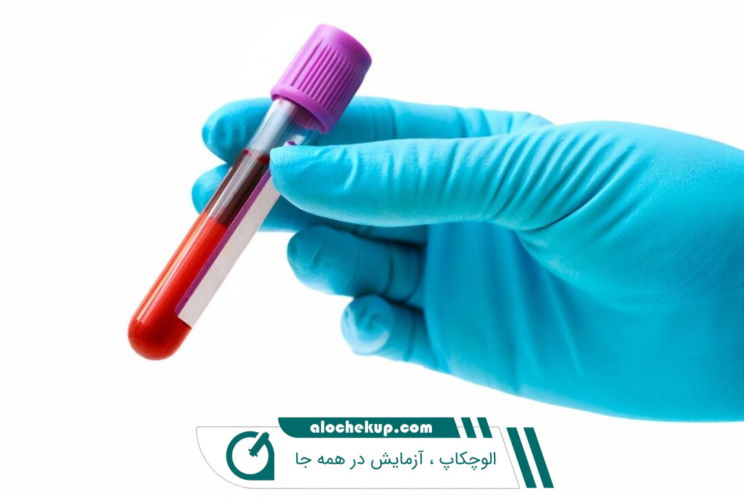 بررسی آزمایش خون برای تشخیص مشکل mchc بالا