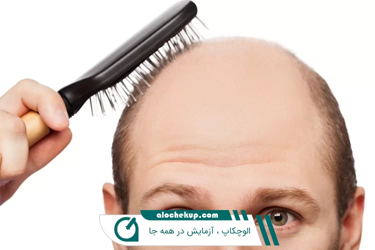تقویت موی سر + عوامل موثر در تضعیف ریشه مو