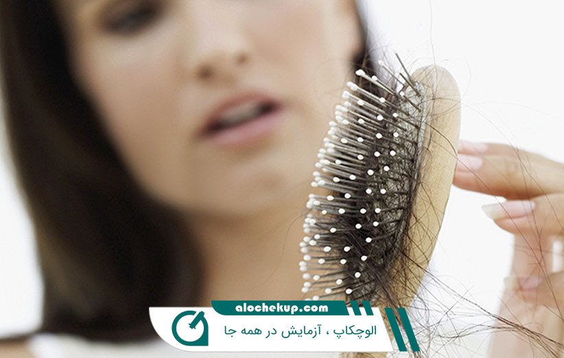 ریزش مو در زنان + علت و درمان ریزش موی زنان